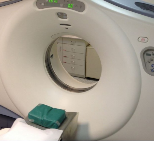 Компьютерный томограф поможет определить состояние пациента с подозрением на инсульт.